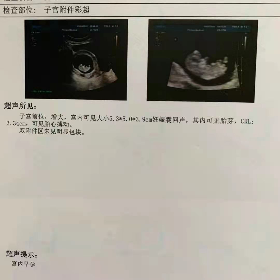 武汉妇产孕检报告